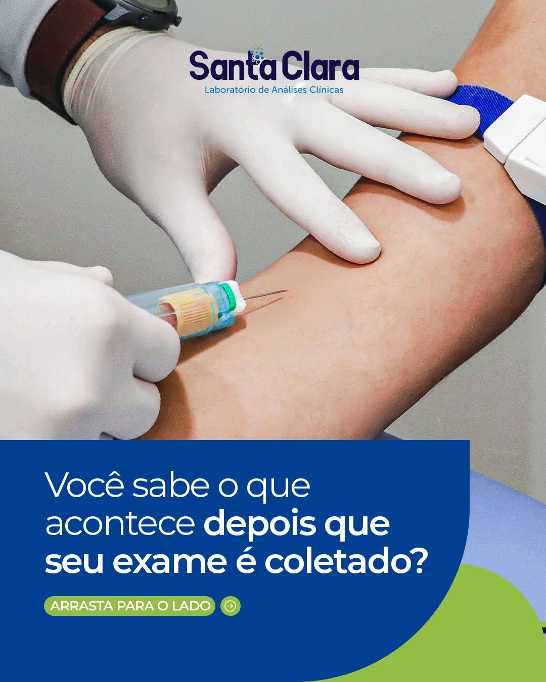 Por trás de cada exame, existe um processo que vai muito além da coleta.

Desde a identificação da amostra até a análise em equipamentos de alta tecnologia, cada etapa é realizada com rigor, cuidado e precisão para garantir resultados confiáveis.

Tudo isso é acompanhado por profissionais qualificados, que asseguram a qualidade em cada detalhe.

Porque no Laboratório Santa Clara, seu exame não é apenas um procedimento é parte essencial do cuidado com a sua saúde.